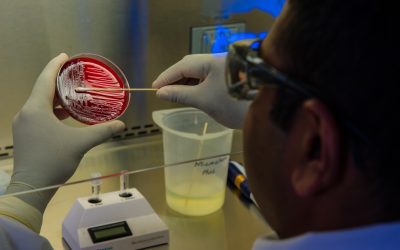 Stool Tests vs Gut Health Tests vs Gut Microbiome Tests